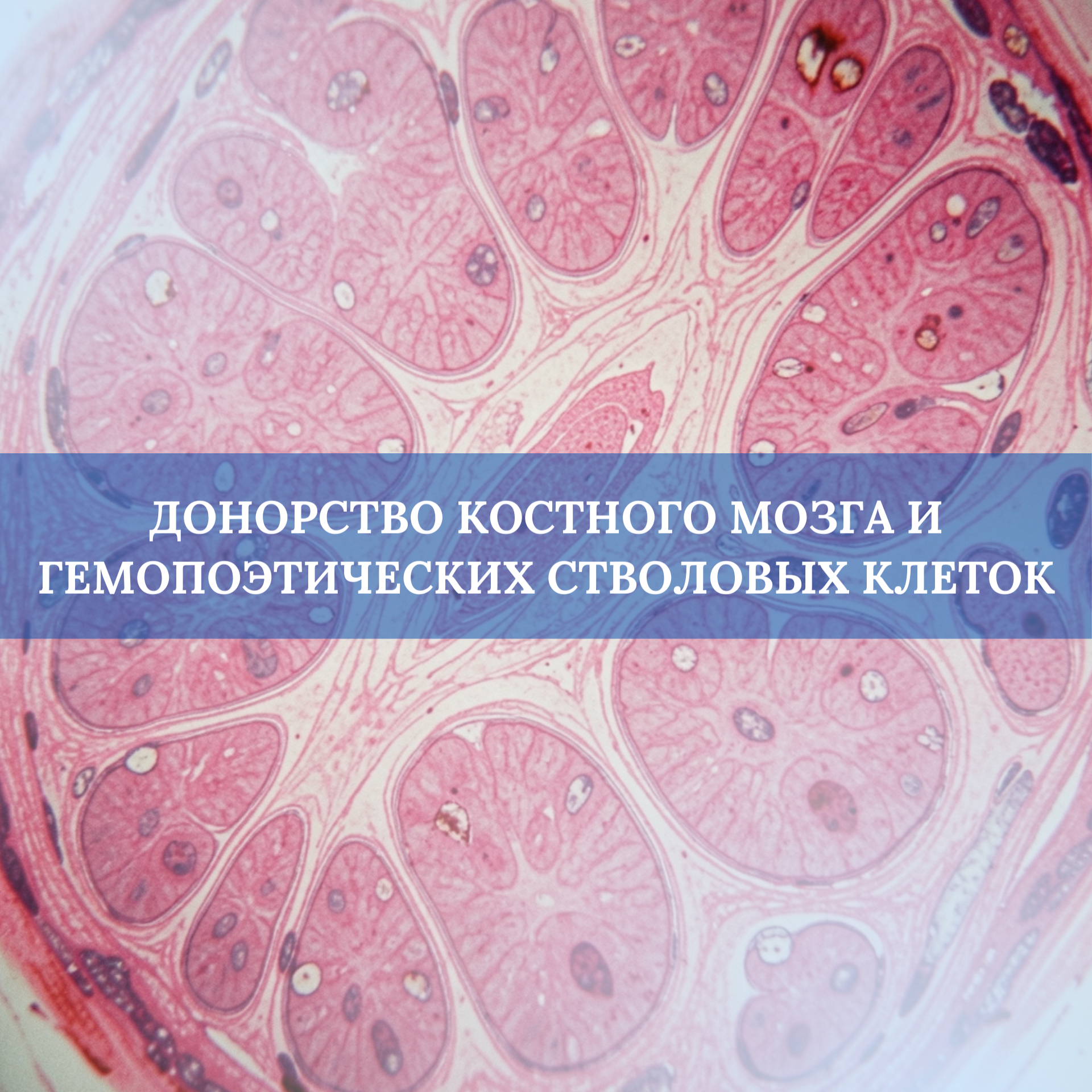 Донорство костного мозга и гемопоэтических стволовых клеток